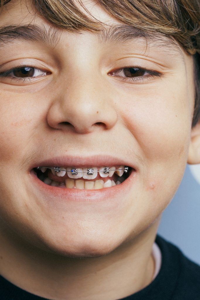 Ortodonzia tradizionale